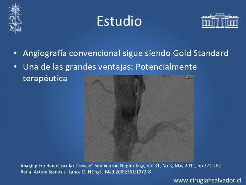 Diapositiva 14 de Hipertensión Renovascular