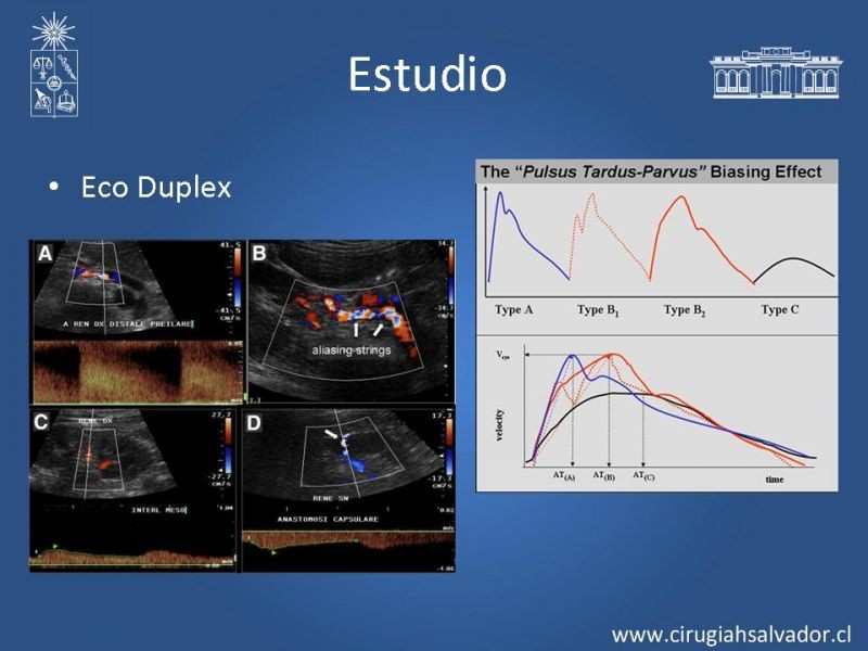 Diapositiva 9 de Hipertensión Renovascular