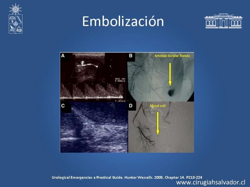 Diapositiva 14 de Priapismo