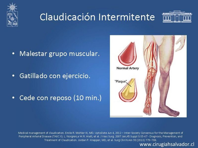 Diapositiva 1 de EAO Tto Médico y Cx (Claudicadores)