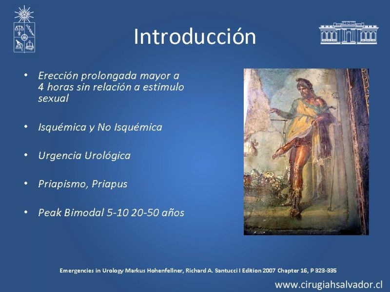Diapositiva 2 de Priapismo