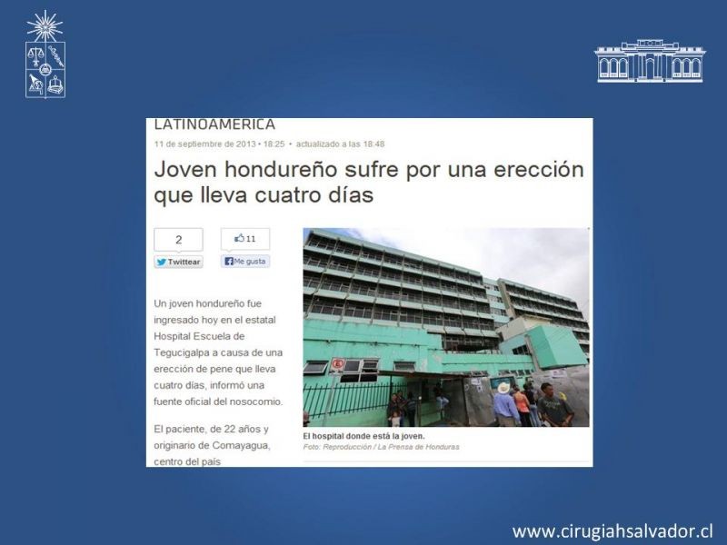 Diapositiva 1 de Priapismo