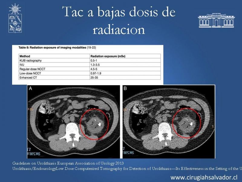 Diapositiva 18 de Urolitiasis: Manejo en urgencia