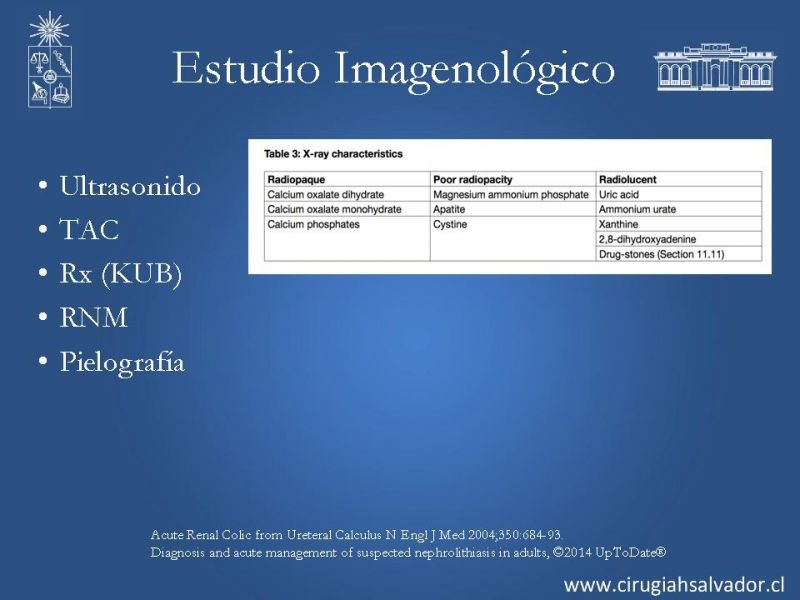 Diapositiva 19 de Urolitiasis: Manejo en urgencia