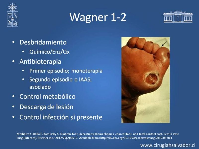 Diapositiva 9 de Manejo del Pie Diabético