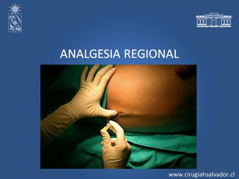 Diapositiva 29 de Manejo del dolor agudo postoperatorio