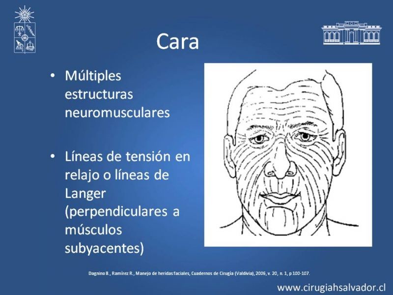 Diapositiva 6 de Heridas faciales complejas