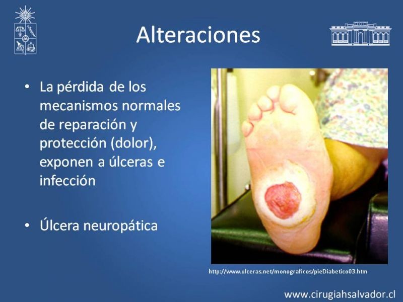 Diapositiva 2 de Manejo del Pie Diabético