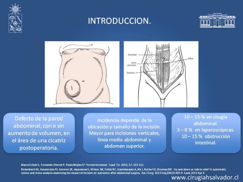 Diapositiva 1 de Hernia incisional: Alternativas de tratamiento