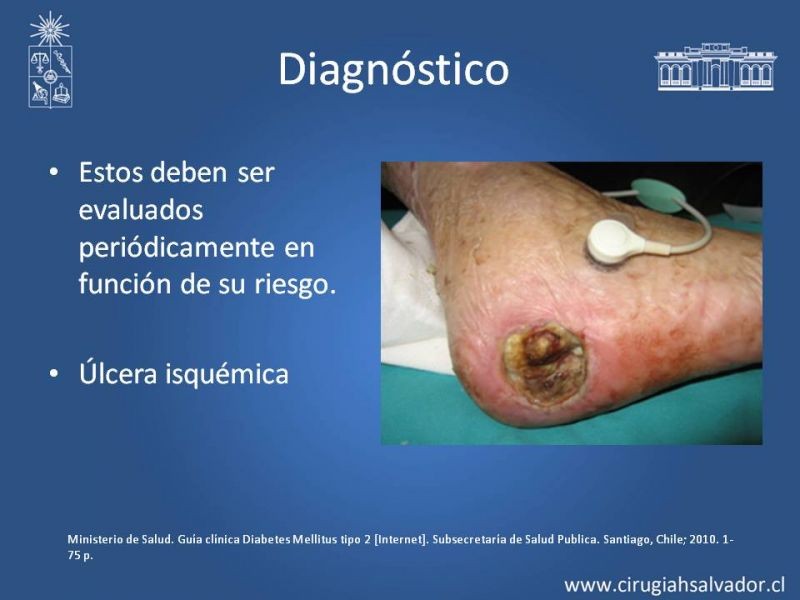 Diapositiva 3 de Manejo del Pie Diabético