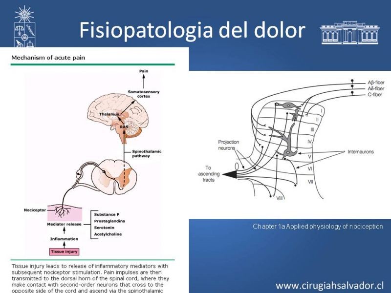 Diapositiva 5 de Manejo del dolor agudo postoperatorio