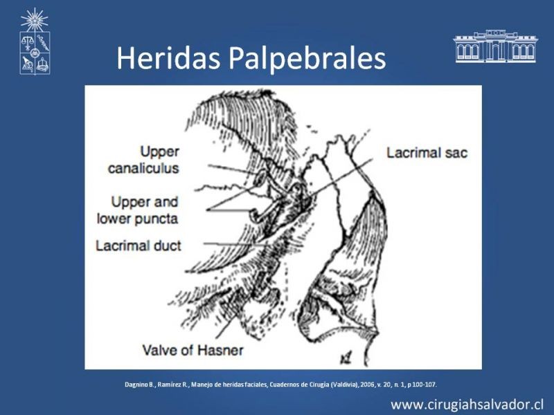 Diapositiva 23 de Heridas faciales complejas