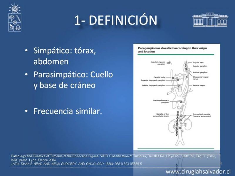 Diapositiva 3 de Paraganglioma cervical