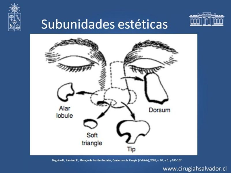 Diapositiva 26 de Heridas faciales complejas