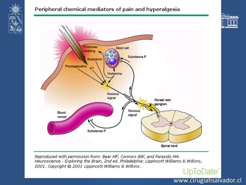 Diapositiva 4 de Manejo del dolor agudo postoperatorio