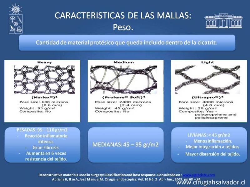Diapositiva 7 de Hernia incisional: Alternativas de tratamiento