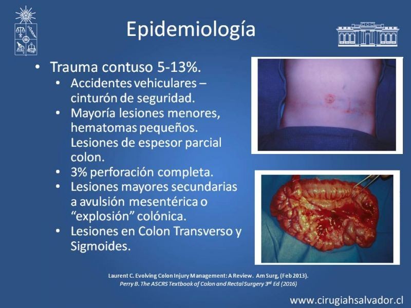 Diapositiva 3 de Trauma de Colon
