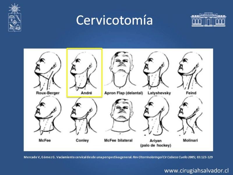 Diapositiva 38 de Absceso cervical y vías de abordaje