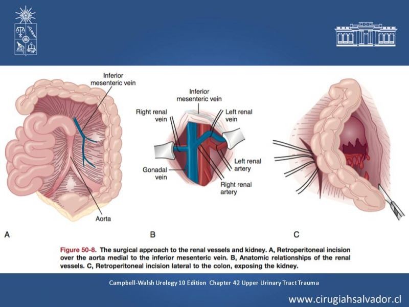 Diapositiva 12 de Manejo Quirúrgico del Trauma Renal
