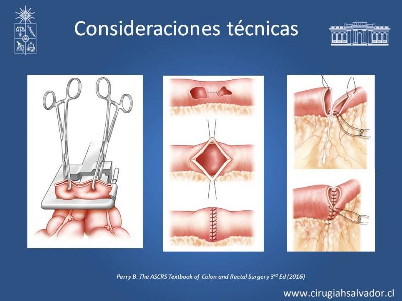 Diapositiva 26 de Trauma de Colon