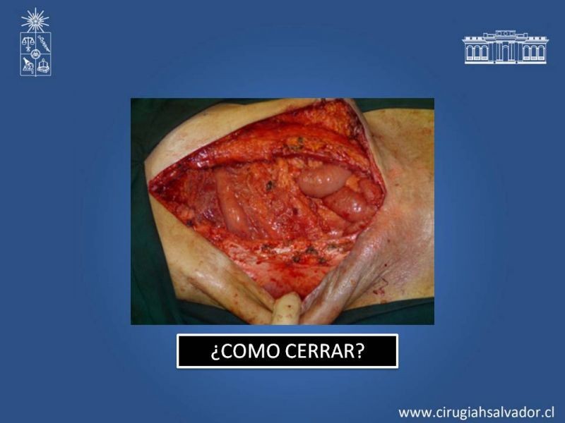 Diapositiva 36 de Evisceración