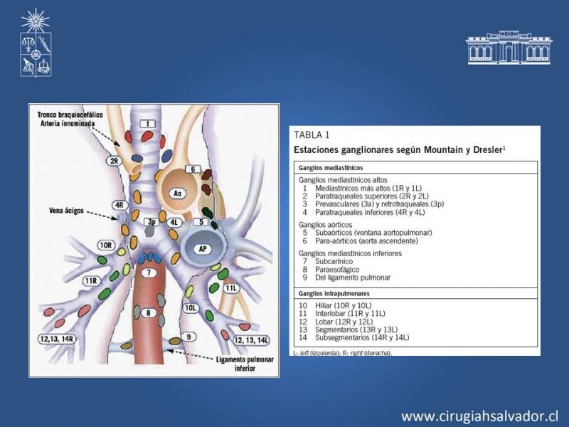Diapositiva 5 de Etapificacion Mediastinica