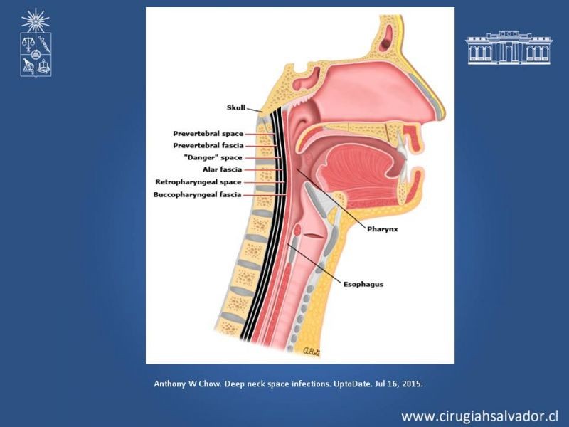 Diapositiva 6 de Absceso cervical y vías de abordaje