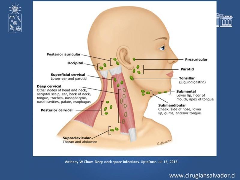 Diapositiva 25 de Absceso cervical y vías de abordaje