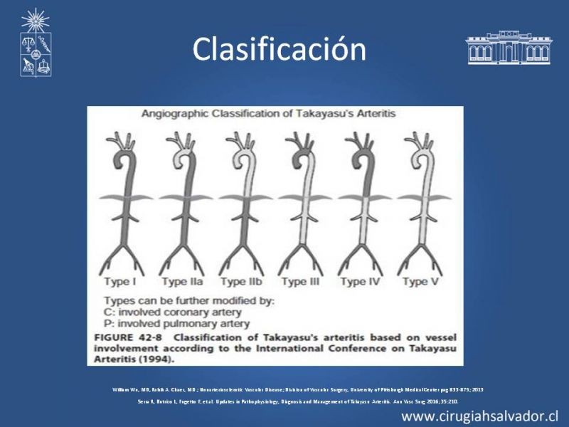 Diapositiva 13 de Enfermedad arterial no aterosclerótica