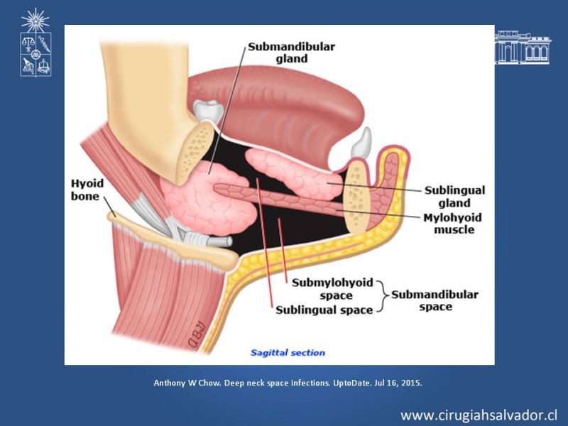 Diapositiva 8 de Absceso cervical y vías de abordaje