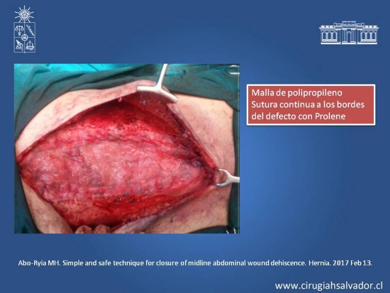 Diapositiva 45 de Evisceración