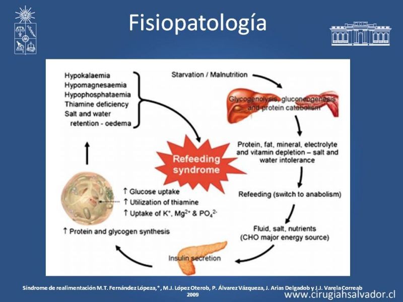 Diapositiva 9 de Síndrome de Realimentación