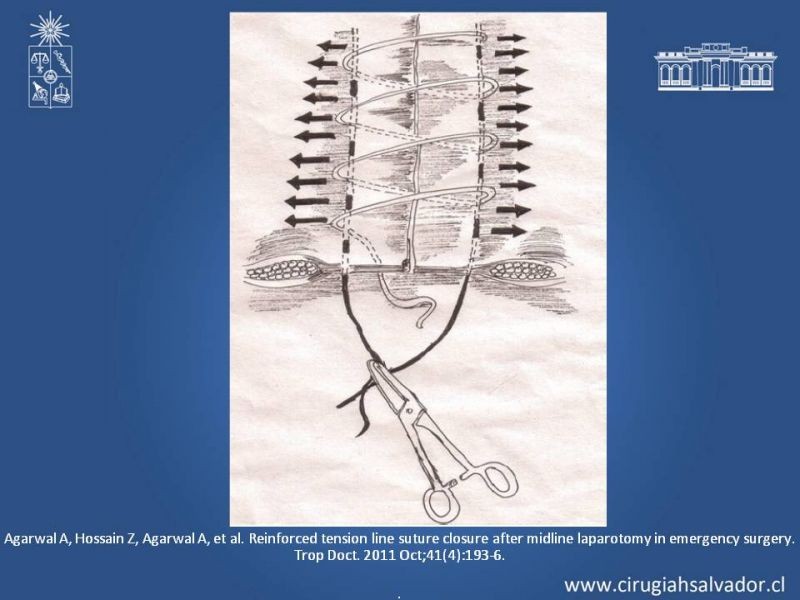 Diapositiva 32 de Evisceración