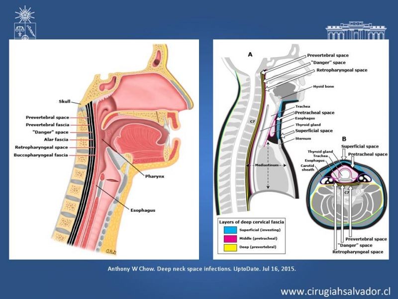 Diapositiva 15 de Absceso cervical y vías de abordaje