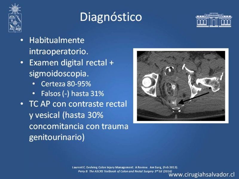 Diapositiva 30 de Trauma de Colon