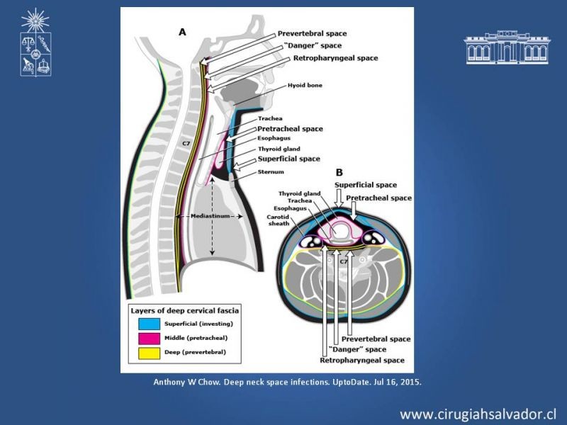 Diapositiva 5 de Absceso cervical y vías de abordaje