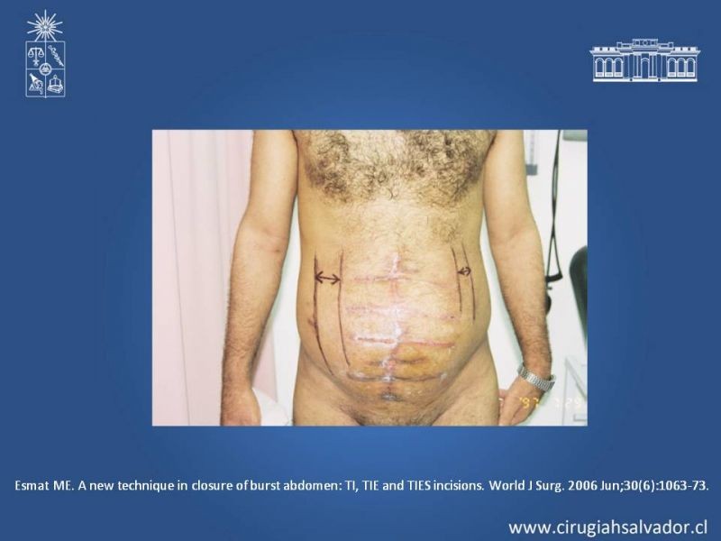 Diapositiva 40 de Evisceración
