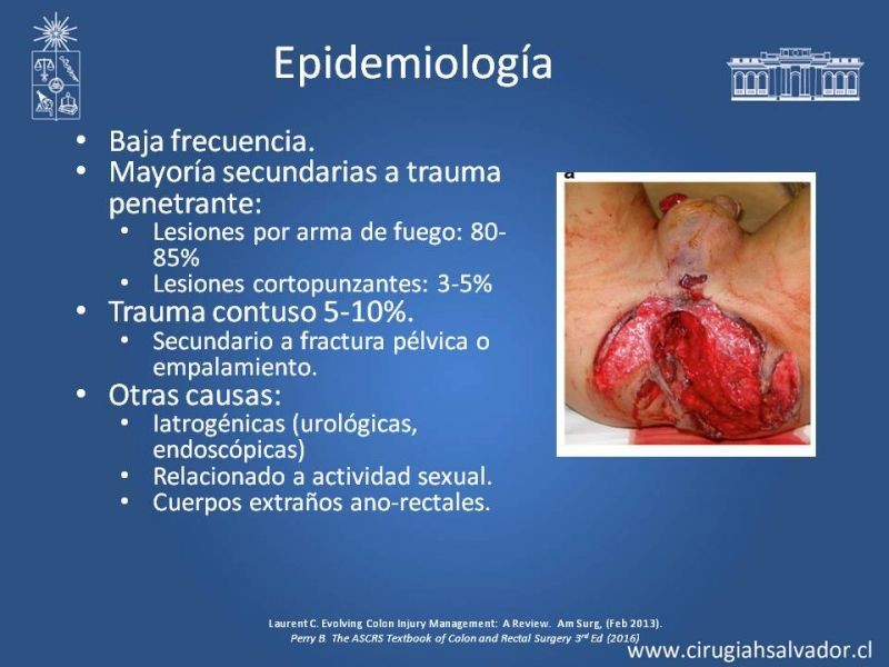 Diapositiva 29 de Trauma de Colon
