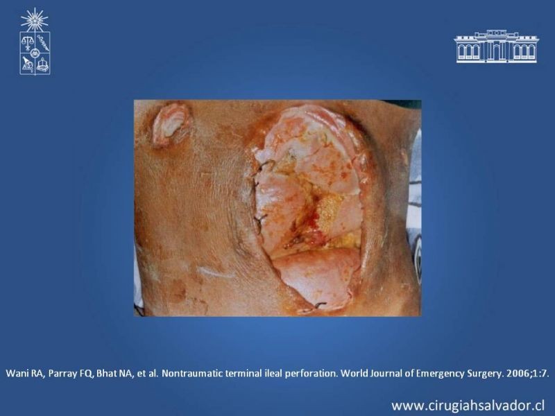 Diapositiva 5 de Evisceración