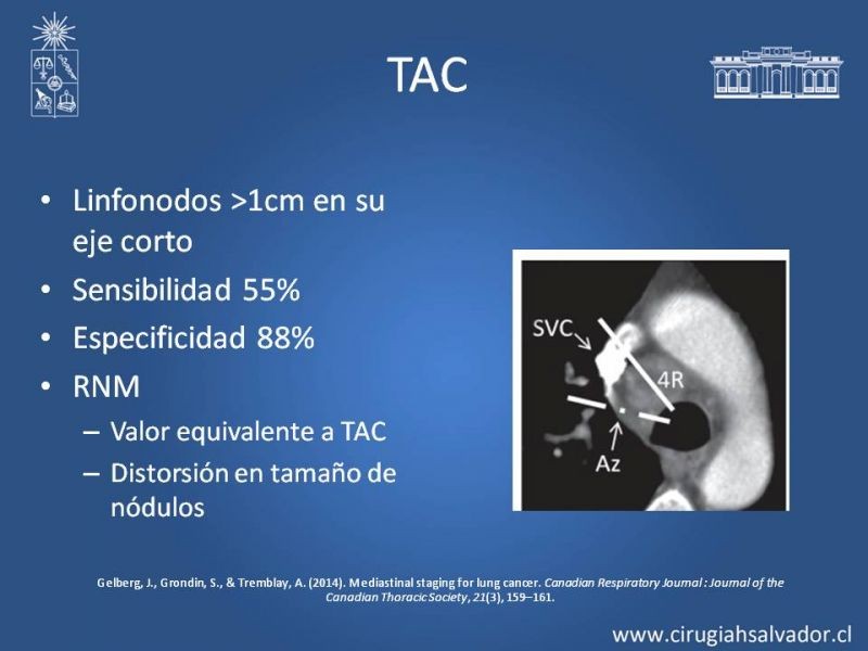 Diapositiva 8 de Etapificacion Mediastinica