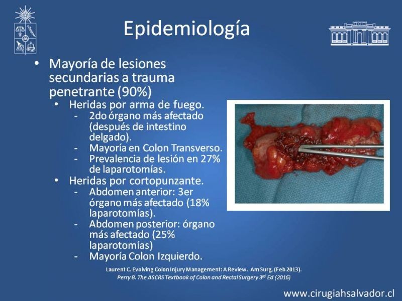 Diapositiva 2 de Trauma de Colon