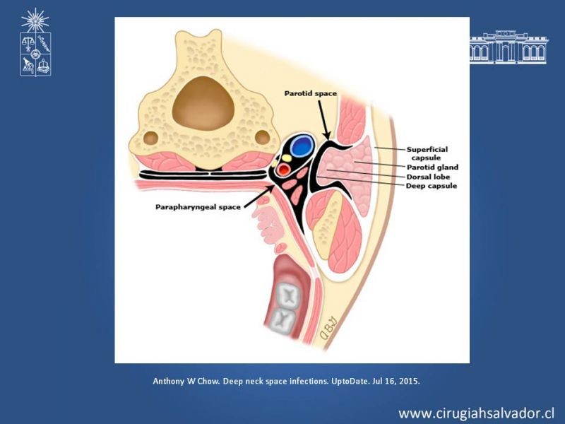 Diapositiva 23 de Absceso cervical y vías de abordaje