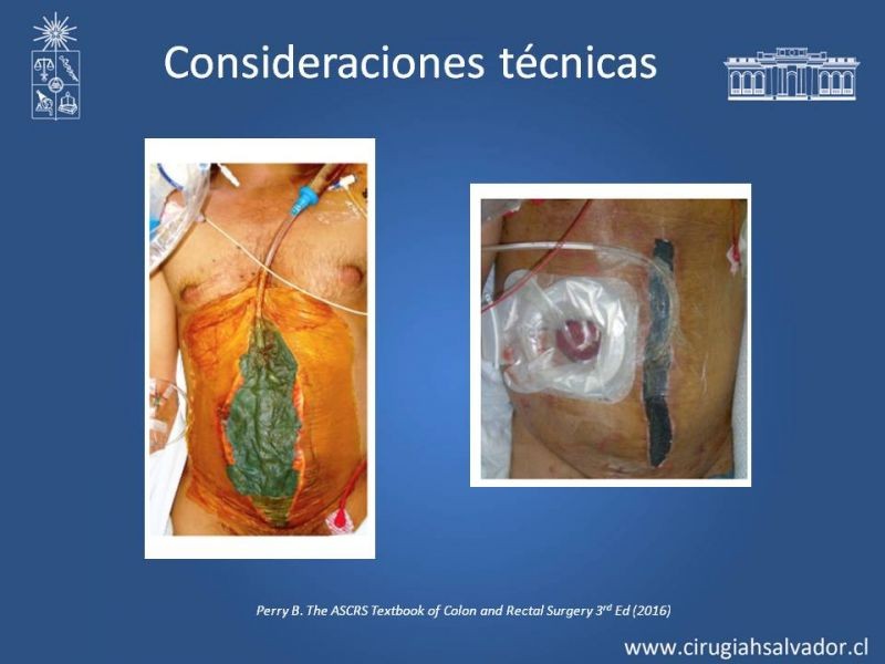 Diapositiva 27 de Trauma de Colon