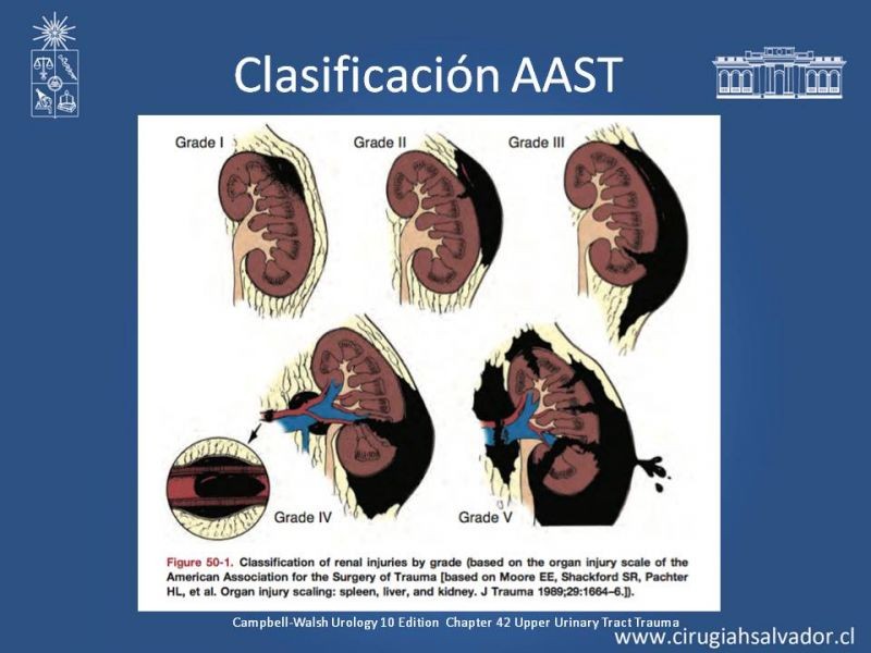 Diapositiva 4 de Manejo Quirúrgico del Trauma Renal