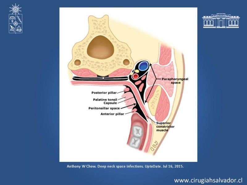 Diapositiva 20 de Absceso cervical y vías de abordaje