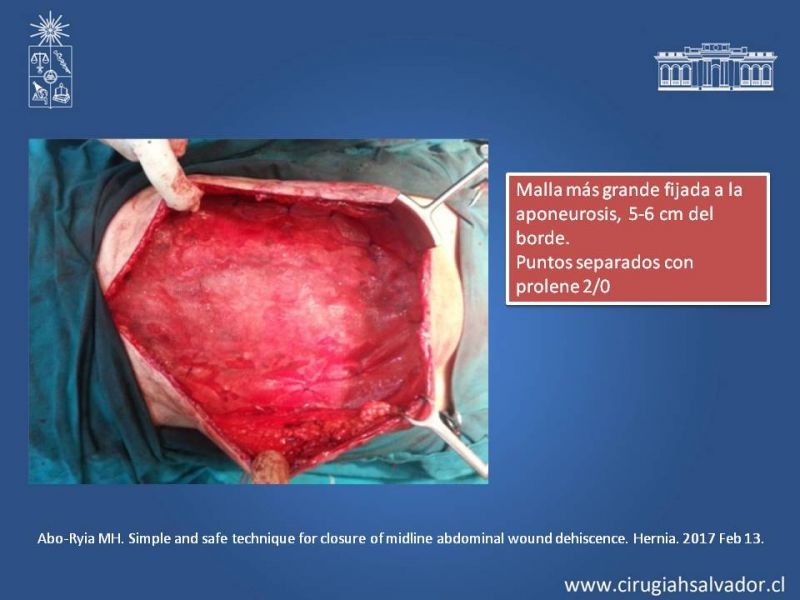Diapositiva 46 de Evisceración