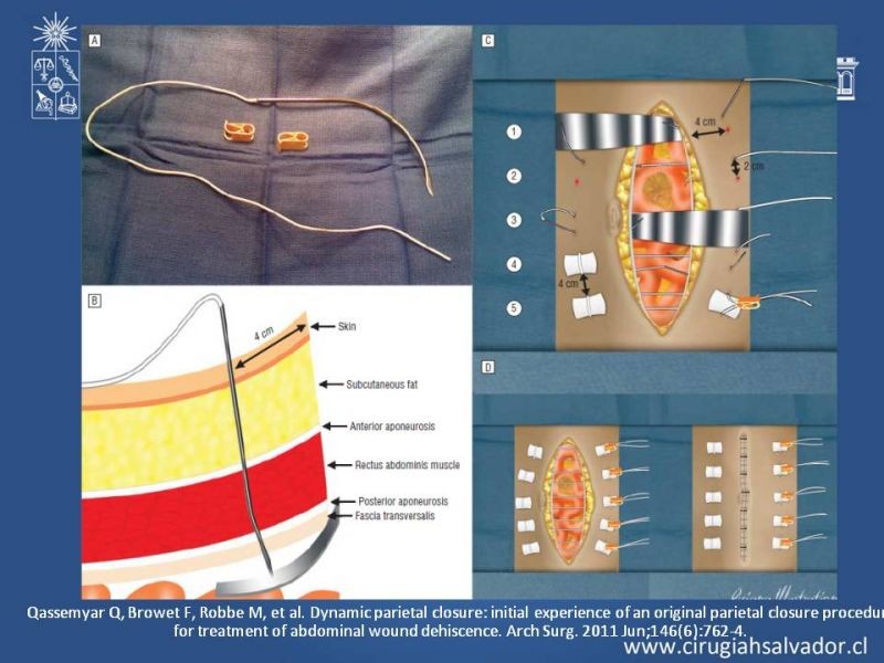 Diapositiva 49 de Evisceración