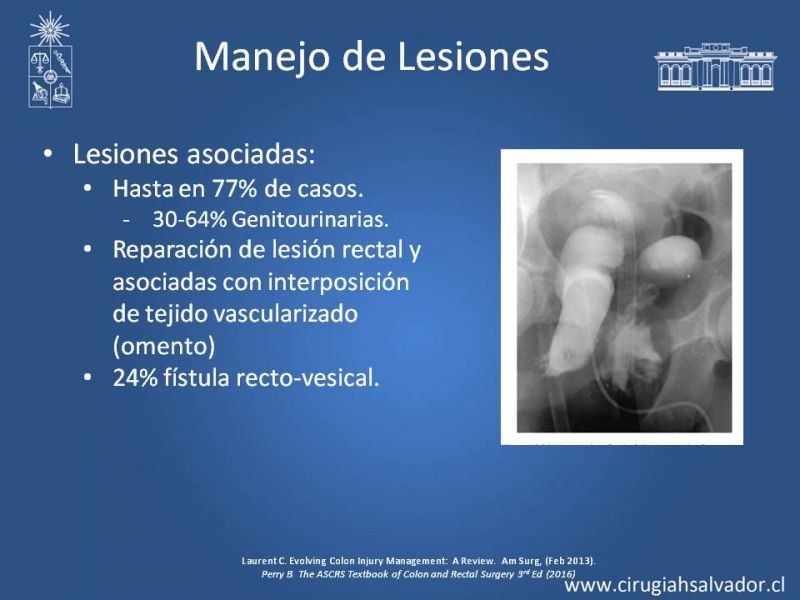 Diapositiva 38 de Trauma de Colon