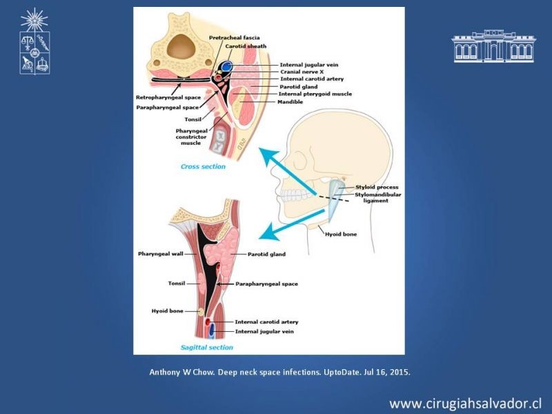 Diapositiva 11 de Absceso cervical y vías de abordaje