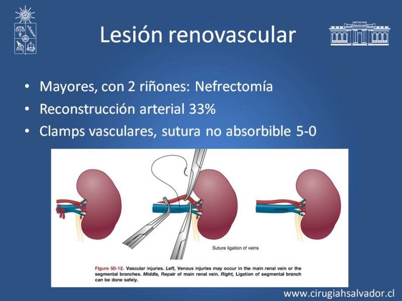 Diapositiva 17 de Manejo Quirúrgico del Trauma Renal